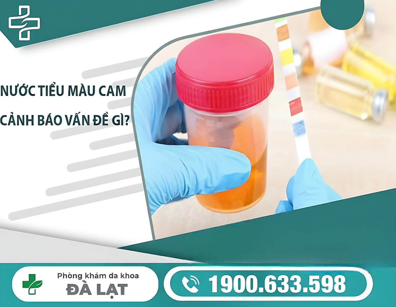 Hình ảnh minh họa